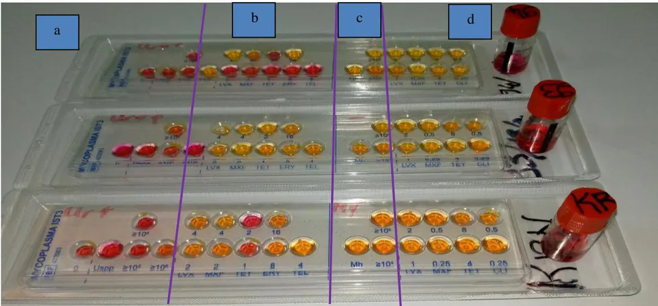 Figure 4: Identification et antibiogramme des Ureaplasma spp et Mycoplasma hominis