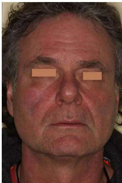 Fig. 15: Final Image After 1,5 Years