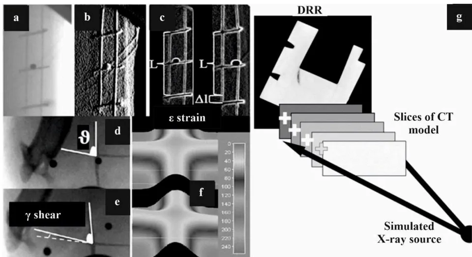 Figure 7: (a) A single X-ray image (one of thousands) from the dynamic stereovideoradiography sequence, showing the internal structure of a target under strain or shear; (b to f) show different image processing techniques to detect major markers or landmarks on the target so the resulting relative localized strain and shear can be calculated; (g) CT model projection, where the CT data is resampled into equally spaced planes along the viewing direction, generating a digitally reconstructed radiograph (DRR) by summing pixel values along projected rays from the X-ray source to the image plane.