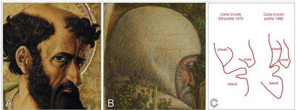 Figure 4: Self-portrait analysis of Carlo Crivelli. (A) Self-portrait impersonating Saint Paul in Crivelli's polyptych altarpiece of Sant'Emidio in the cathedral of Ascoli Piceno, 1473 (Casalini 2004). Note that the original image was flipped horizontally for correlating it with the profile in B; (B) Herein proposed self-portrait in Crivelli's Beato Gabriele Ferretti, 1489, National Gallery of London; C) Trait line profiling of cheek, beard, and nose comparing the profiles in A and B.