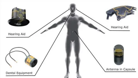 Figure 6: Use of 3D-MID devices in medicine The use of FPCB-based technology for arbitrary-shaped devices is illustrated in