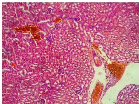 Figure 2: Histologic sections of liver excised from animals that received only distilled water (control) and those that received 300-5000mg/kg of aqueous extract of Picralima nitida. The liver tissue show parallel radially arranged plates of hepatocytes with the portal space and periportal zone filled with a smooth to slightly floccular pink fluid material common with edema and congested aggregates of red blood cells were also seen in both control and treated group ix. Control (vascular congestion)