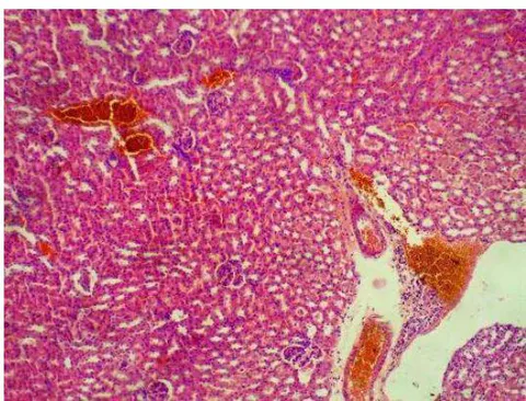 Figure 6: Histologic sections of liver tissue show parallel radially arranged plates of hepatocytes with the portal space and periportal zone filled with a smooth to slightly floccular pink fluid material common with edema and congested aggregates of red blood cells also seen. The liver sections for untreated and those treated with 300-5000mg/kg of ethanolic extract of Picralima nitida had mild to severe vascular congestion f. Control (vascular congestion)