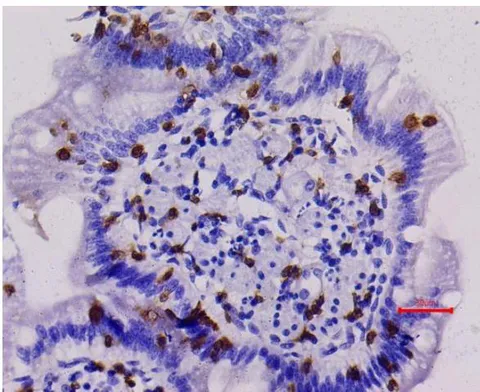 Fig. 6: Erosion/Ulcer in the Colonic Mucosa